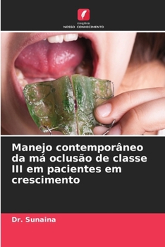 Manejo contemporâneo da má oclusão de classe III em pacientes em crescimento (Portuguese Edition)