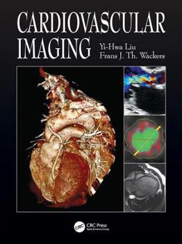 Paperback Cardiovascular Imaging Book