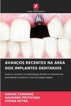 Paperback Avanços Recentes Na Área DOS Implantes Dentários [Portuguese] Book