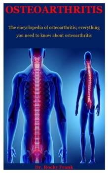 Paperback Osteoarthritis: The Encyclopedia Of Osteoarthritis; Everything You Need To Know About Osteoarthritis Book