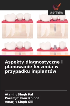 Aspekty diagnostyczne i planowanie leczenia w przypadku implantów (Polish Edition)