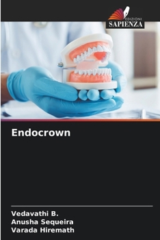 Endocrown (Portuguese Edition)