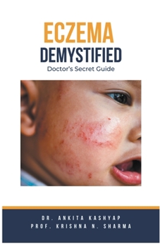 Paperback Eczema Demystified: Doctor's Secret Guide Book