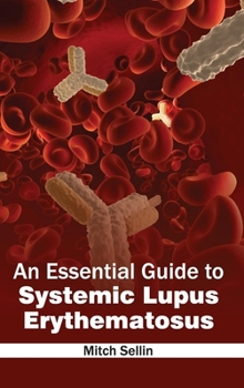 Hardcover Essential Guide to Systemic Lupus Erythematosus Book