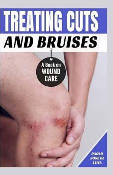 Paperback Treating Cuts and Bruises: A Book on Wound Care Book