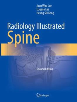 Paperback Radiology Illustrated: Spine Book