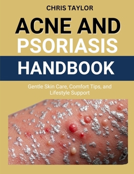 ACNE AND PSORIASIS HANDBOOK: Gentle Skin Care, Comfort Tips, and Lifestyle Support