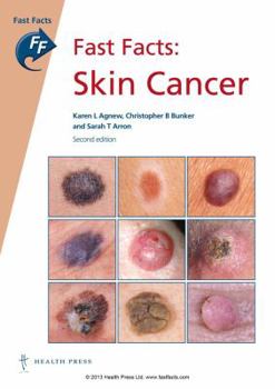 Paperback Fast Facts: Skin Cancer Book