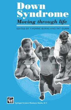 Paperback Down Syndrome: Moving Through Life Book