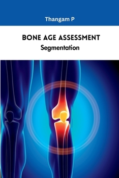 Paperback Bone Age Assessment Segmentation Book