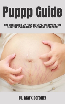 Paperback Puppp Guide: The Best Guide On How To Cure, Treatment And Relief Of Puppp Rash And Other Pregnancy Book