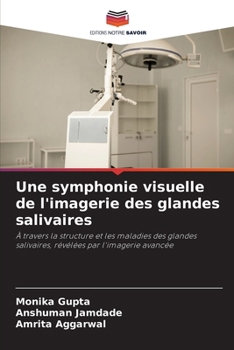 Paperback Une symphonie visuelle de l'imagerie des glandes salivaires [French] Book