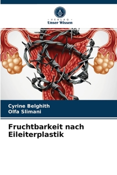 Paperback Fruchtbarkeit nach Eileiterplastik [German] Book