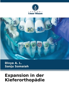 Paperback Expansion in der Kieferorthopädie [German] Book