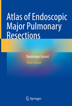 Hardcover Atlas of Endoscopic Major Pulmonary Resections Book