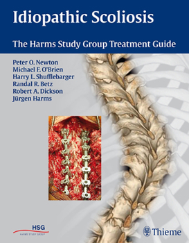 Hardcover Idiopathic Scoliosis: The Harms Study Group Treatment Guide Book