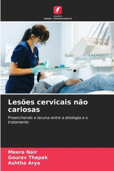 Lesões cervicais não cariosas (Portuguese Edition)