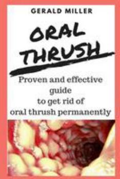 Paperback oral thrush: Premium Candida Cleanse - Yeast Infection Treatment - Oral Thrush Treatment - Organic Probiotic Support - Ultimate Cle Book