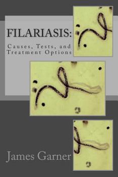 Paperback Filariasis: Causes, Tests, and Treatment Options Book