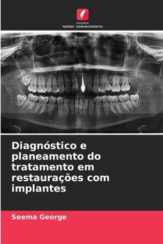 Paperback Diagnóstico e planeamento do tratamento em restaurações com implantes [Portuguese] Book