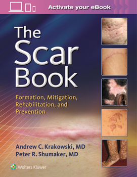 Hardcover The Scar Book: Formation, Mitigation, Rehabilitation and Prevention Book