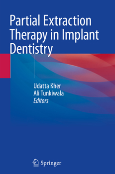 Paperback Partial Extraction Therapy in Implant Dentistry Book