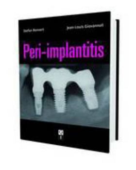 Hardcover Peri-Implantitis Book