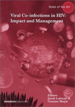 Paperback Viral Co-Infections in HIV: Impact and Management Book