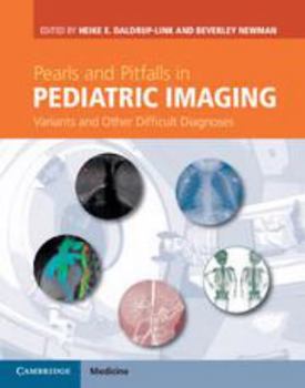 Electronics Pearls and Pitfalls in Pediatric Imaging: Variants and Other Difficult Diagnoses Book