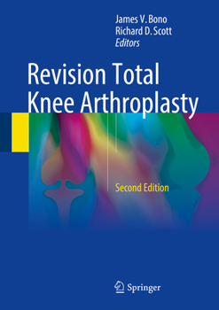 Total Knee Arthroplasty E-Book