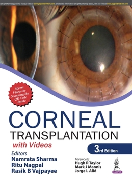 Hardcover Corneal Transplantation: with Videos Book