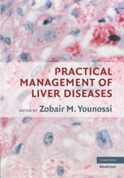 Hardcover Practical Management of Liver Diseases Book