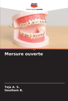 Morsure ouverte (French Edition)