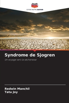 Paperback Syndrome de Sjogren [French] Book