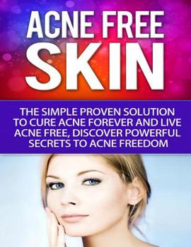 Paperback Acne-Free Skin: Simple Proven Solution To Cure Acne Forever and Live Acne-Free, Discover Powerful Secrets to Acne Freedom Book