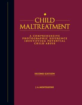 Hardcover Child Maltreatment: A Comprehensive Photographic Reference Identifying Potential Child Abuse, 2nd Ed. Book