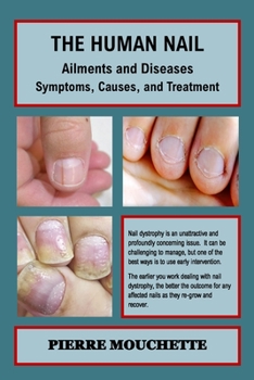 Paperback THE HUMAN NAIL - Ailments and Diseases: Symptoms, Causes, and Treatment Book