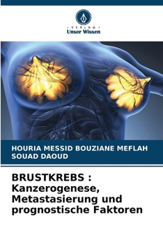 Brustkrebs: Kanzerogenese, Metastasierung und prognostische Faktoren