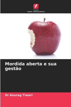 Paperback Mordida aberta e sua gestão [Portuguese] Book