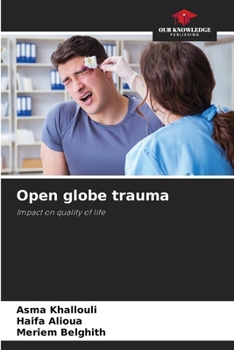 Paperback Open globe trauma Book