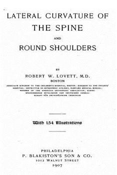 Paperback Lateral Curvature of the Spine and Round Shoulders Book