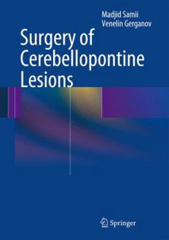 Hardcover Surgery of Cerebellopontine Lesions Book