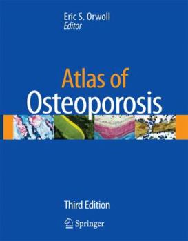 Hardcover Atlas of Osteoporosis [With CDROM] Book