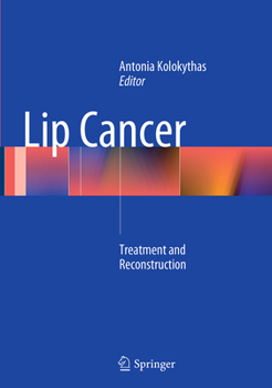 Paperback Lip Cancer: Treatment and Reconstruction Book