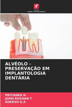 Paperback Alvéolo - Preservação Em Implantologia Dentária [Portuguese] Book