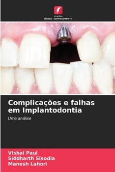 Paperback Complicações e falhas em Implantodontia [Portuguese] Book