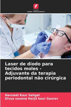 Paperback Laser de díodo para tecidos moles - Adjuvante da terapia periodontal não cirúrgica [Portuguese] Book