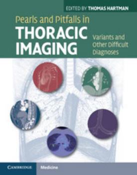 Hardcover Pearls and Pitfalls in Thoracic Imaging: Variants and Other Difficult Diagnoses Book