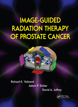 Hardcover Image-Guided Radiation Therapy of Prostate Cancer Book