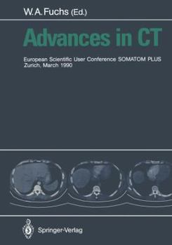Paperback Advances in CT: European Scientific User Conference Somatom Plus Zurich, March 1990 Book